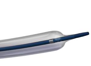 کتتر دیلاتاسیون