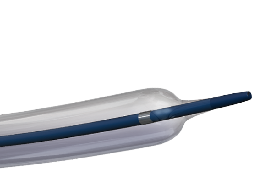 کتتر دیلاتاسیون